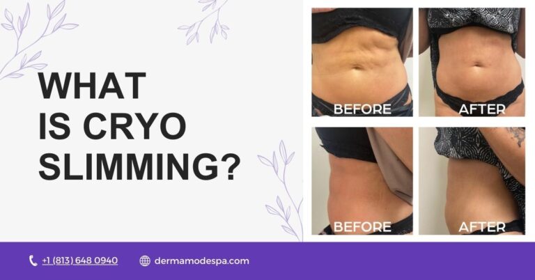 What is Cryo Slimming