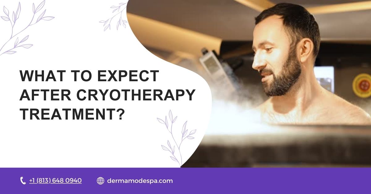 What to Expect after Cryotherapy Treatment